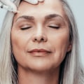 Botox ¿para quién es adecuado?