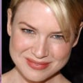 ¿cómo funciona el botox?
