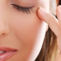 ¿ayudará el botox a los párpados caídos?