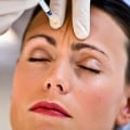 ¿Son legales las fiestas de botox?