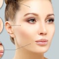 Cuando el botox deja de funcionar?