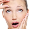 Donde se puede usar el botox?