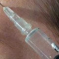Por qué el botox en la vejiga?