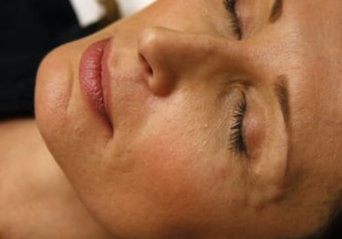 ¿quién no debe usar botox?