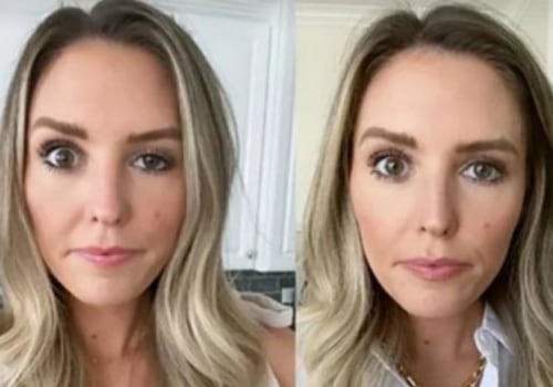 Cuando el botox hace que los párpados se caigan?