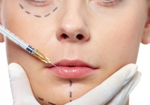 ¿qué es el botox?