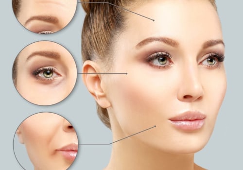 Cuando el botox deja de funcionar?