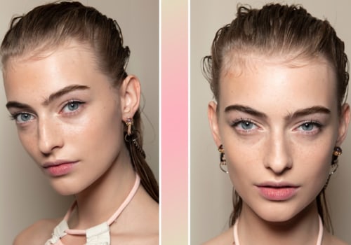 Botox ¿quién puede hacerlo?