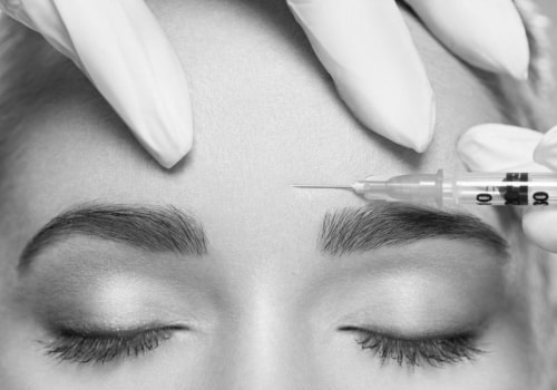 ¿qué puede hacer el botox?