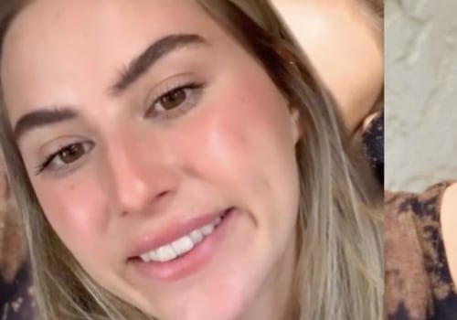 ¿el botox es malo para ti?