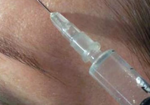Por qué el botox en la vejiga?