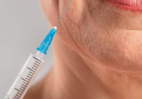 ¿cómo el botox previene las arrugas?